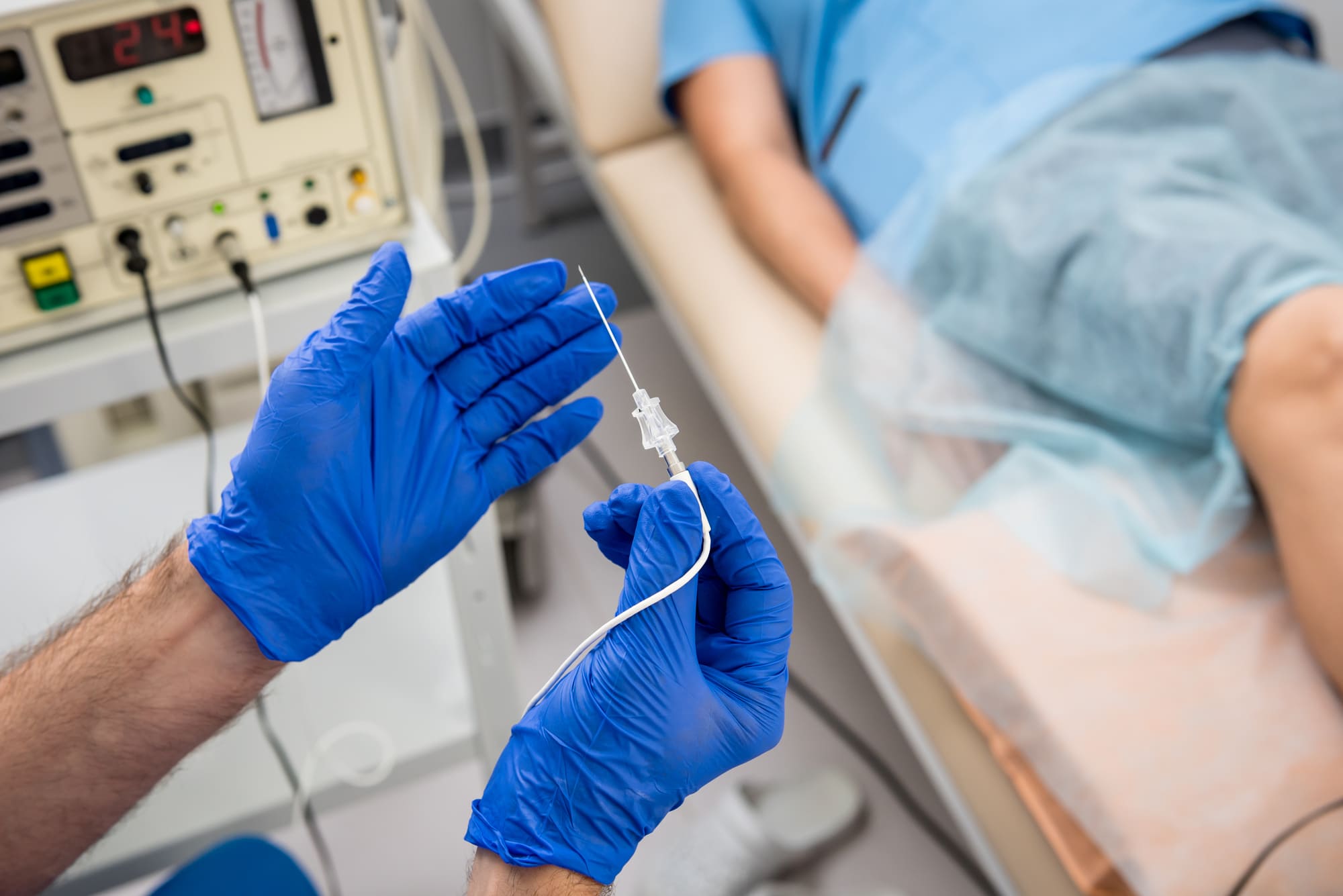 radiofrequency